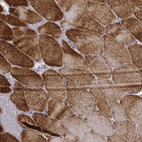 Immunohistochemical staining of human skeletal muscle shows strong cytoplasmic positivity in striated muscle fibers.
