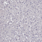 Immunohistochemical staining of human liver shows no positivity in hepatocytes as expected.