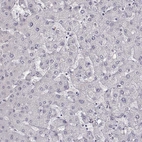 Immunohistochemical staining of human liver shows no positivity in hepatocytes as expected.
