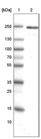 Lane 1: Marker [kDa]_br/_Lane 2: Human skeletal muscle tissue lysate