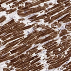 Immunohistochemical staining of human heart muscle shows very strong cytoplasmic positivity in cardiomyocytes.