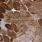 Immunohistochemical staining of human skeletal muscle shows strong cytoplasmic positivity in striated muscle fibers.