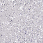 Immunohistochemical staining of human liver shows no positivity in hepatocytes as expected.
