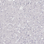 Anti-MYH6 Antibody