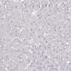 Immunohistochemical staining of human liver shows no positivity in hepatocytes as expected.