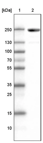 Lane 1: Marker [kDa]_br/_Lane 2: Human skeletal muscle tissue lysate