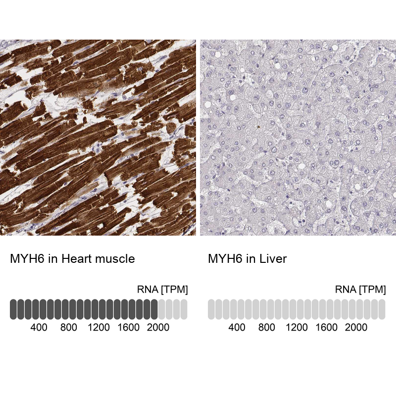 Anti-MYH6 Antibody