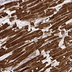 Immunohistochemical staining of human heart muscle shows very strong cytoplasmic positivity in cardiomyocytes.