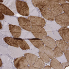 Immunohistochemical staining of human skeletal muscle shows strong cytoplasmic positivity in striated muscle fibers.