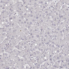 Immunohistochemical staining of human liver shows no positivity in hepatocytes as expected.