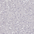 Anti-MYH6 Antibody