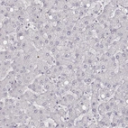 Immunohistochemical staining of human liver shows no positivity in hepatocytes as expected.