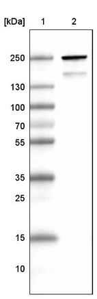 Lane 1: Marker [kDa]_br/_Lane 2: Human skeletal muscle tissue lysate