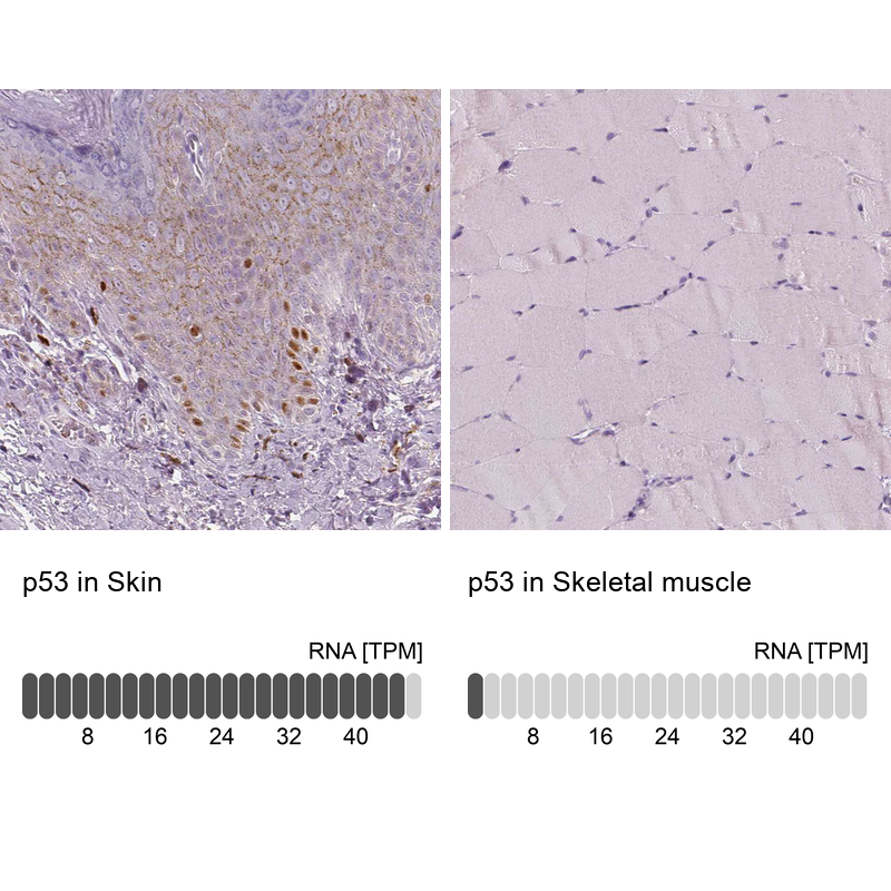 Anti-TP53 Antibody
