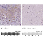 Anti-TP53 Antibody