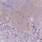 Immunohistochemical staining of human skin shows moderate to strong nuclear positivity in a subset of epidermal cells.