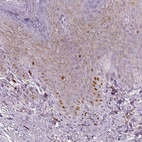 Immunohistochemical staining of human skin shows moderate to strong nuclear positivity in a subset of epidermal cells.
