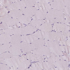Immunohistochemical staining of human skeletal muscle shows no positivity in striated muscle fibers as expected.
