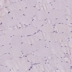 Immunohistochemical staining of human skeletal muscle shows no positivity in striated muscle fibers as expected.