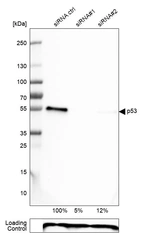 Western blot analysis in U-251MG cells transfected with control siRNA, target specific siRNA probe #1 and #2, using Anti-p53 antibody. Remaining relative intensity is presented. Loading control: Anti-PPIB.