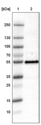Lane 1: Marker [kDa]_br/_Lane 2: Human cell line U-251