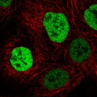 Immunofluorescence staining in A431 cell line with Anti-p53 monoclonal antibody, showing cell cycle dependent nuclear (without nucleoli) staining in green. Microtubule- and nuclear probes are visualized in red and blue respectively (where available).