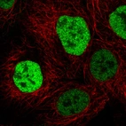 Immunofluorescence staining in A431 cell line with Anti-p53 monoclonal antibody, showing cell cycle dependent nuclear (without nucleoli) staining in green. Microtubule- and nuclear probes are visualized in red and blue respectively (where available).