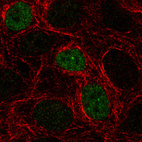 Immunofluorescence staining in MCF7 cell line with Anti-p53 monoclonal antibody, showing cell cycle dependent nuclear (without nucleoli) staining in green. Microtubule- and nuclear probes are visualized in red and blue respectively (where available).