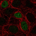 Immunofluorescence staining in MCF7 cell line with Anti-p53 monoclonal antibody, showing cell cycle dependent nuclear (without nucleoli) staining in green. Microtubule- and nuclear probes are visualized in red and blue respectively (where available).