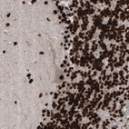 Immunohistochemical staining of human cerebellum shows strong nuclear positivity in granular and molecular layer cells, as well as in Purkinje cells.