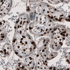 Immunohistochemical staining of human placenta shows strong nuclear immunoreactivity in trophoblast.