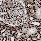 Anti-PARP1 Antibody