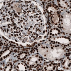 Immunohistochemical staining of human kidney shows nuclear positivity in both tubuli and glomeruli.