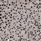 Immunohistochemical staining of human liver shows nuclear immunoreactivity in hepatocytes.