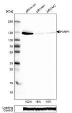 Western blot analysis in RT-4 cells transfected with control siRNA, target specific siRNA probe #1 and #2, using Anti-PARP1 antibody. Remaining relative intensity is presented. Loading control: Anti-GAPDH.