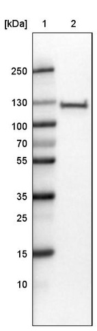Lane 1: Marker [kDa]_br/_Lane 2: Human cell line RT-4