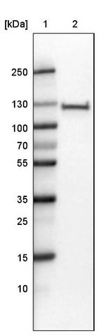 Lane 1: Marker [kDa]_br/_Lane 2: Human cell line RT-4