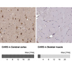 Anti-CARS Antibody