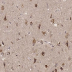 Immunohistochemical staining of human cerebral cortex shows moderate to strong cytoplasmic positivity in neurons.