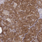 Immunohistochemical staining of human pancreas shows strong cytoplasmic positivity in exocrine glandular cells.
