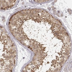 Immunohistochemical staining of human testis shows moderate to strong cytoplasmic positivity in cells in seminiferous ducts.