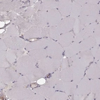Immunohistochemical staining of human skeletal muscle shows no positivity in myocytes as expected.