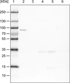 Lane 1: Marker [kDa]_br/_Lane 2: Human cell line HeLa cytoplasmic fraction_br/_Lane 3: Human cell line HeLa membrane fraction_br/_Lane 4: Human cell line HeLa nuclear fraction_br/_Lane 5: Human cell line HeLa chromatin fraction_br/_Lane 6: Human cell line HeLa cytoskeletal fraction