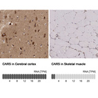 Anti-CARS Antibody