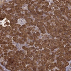 Immunohistochemical staining of human pancreas shows strong cytoplasmic positivity in exocrine glandular cells.