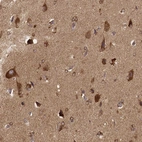 Immunohistochemical staining of human cerebral cortex shows strong cytoplasmic positivity in neurons.
