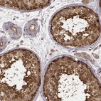 Immunohistochemical staining of human testis shows moderate to strong cytoplasmic positivity in cells in seminiferous ducts.