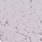 Immunohistochemical staining of human skeletal muscle shows no positivity in myocytes as expected.