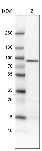 Lane 1: Marker [kDa]_br/_Lane 2: Human cell line U-251 MG
