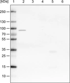 Lane 1: Marker [kDa]_br/_Lane 2: Human cell line HeLa cytoplasmic fraction_br/_Lane 3: Human cell line HeLa membrane fraction_br/_Lane 4: Human cell line HeLa nuclear fraction_br/_Lane 5: Human cell line HeLa chromatin fraction_br/_Lane 6: Human cell line HeLa cytoskeletal fraction